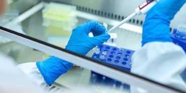 hepatit-laboratuvar-2085096.jpg